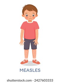 Cute little boy suffering from measles rash allergy skin 