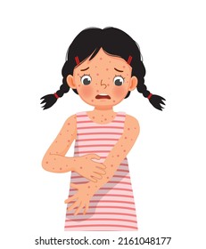 cute little girl scratching her itchy arm suffering from measles rash allergy skin