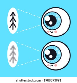 Cute Sad And Happy Human Eyeball Organ Look On Tree Character. Vector Doodle Cartoon Illustration Icon Design. Eye Care, Bad,good Vision,eyeball Problem Character Concept
