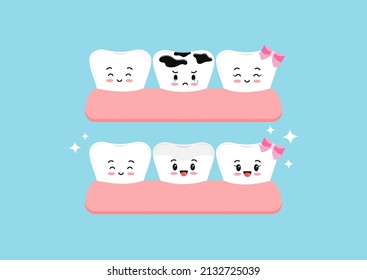 Cute teeth before and after multiple caries in gym dental characters. Tooth dentistry restoration with ceramic porcelain sealant in cavity treatment concept. Flat cartoon clip art vector illustration.