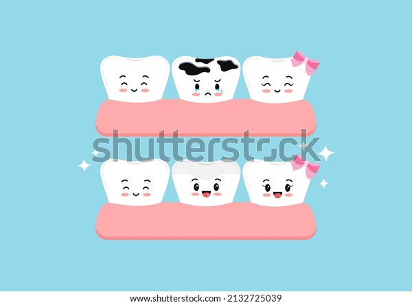 Cute teeth before and after multiple caries\
in gym dental characters. Tooth dentistry restoration with ceramic\
porcelain sealant in cavity treatment concept. Flat cartoon clip\
art vector illustration.