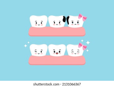 Cute teeth character before and after proximal decay in gym dental icon set isolated. Both tooth with interdental caries hole treatment concept. Flat cartoon dentistry clip art vector illustration