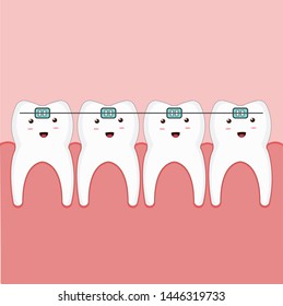 Cute teeth kawaii vector, Dental braces illustration.