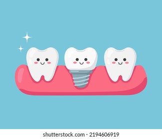 Cute teeth and tooth implant. Vector illustration