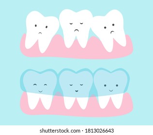 Cute tooth cartoon vector. Invisible dental aligner  concept illustration. Transparent braces for crooked teeth.