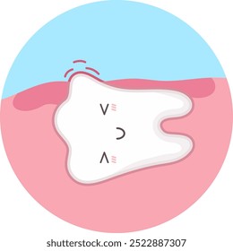 Cute tooth with kawaii face grows sideways under gum. Vector illustration of unhealthy teeth concept.