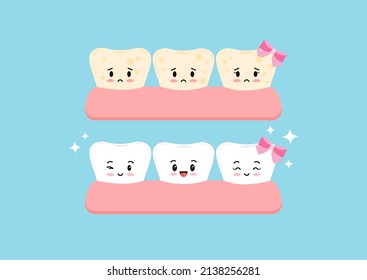 Cute tooth whitening and tooth with yellow plaque before, after icon set. Teeth in gum stain treatment, cleaning concept. Flat cartoon emoji character vector illustration. Dental hygiene stained teeth