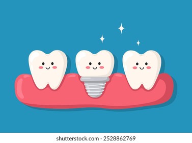 Dentes de caracteres vetoriais lindos com implante dentário. Dentes humanos saudáveis e parafuso de implante na gengiva. Conceito de próteses de implantação na odontologia. Ilustração plana isolada sobre fundo azul.