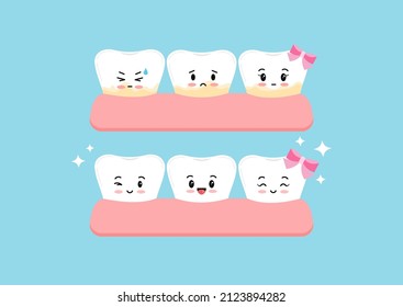 Cute white tooth and with yellow tartar plaque before after kids icon set. Teeth in gum kawaii character stain treatment, remove and cleaning concept. Flat cartoon vector illustration. 