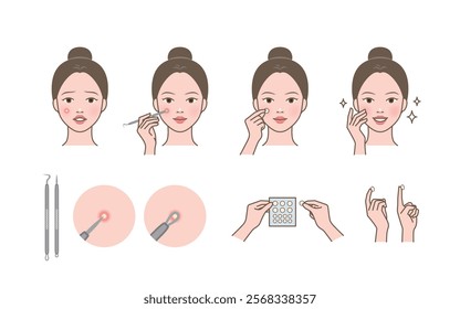 A cute woman character who extracts and removes whitehead, zit, acne with pimple potter tool and trouble patch