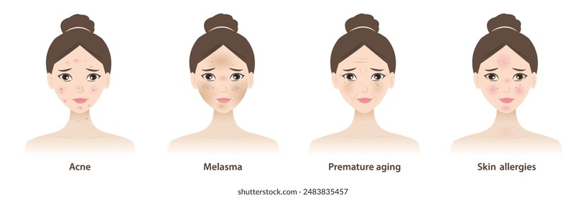 The cute women with skin problems vector illustration isolated on white background. Types of skin problems, acne, pimple, hyperpigmentation, melasma, premature aging, wrinkles and skin allergies.