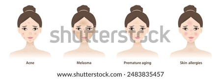 The cute women with skin problems vector illustration isolated on white background. Types of skin problems, acne, pimple, hyperpigmentation, melasma, premature aging, wrinkles and skin allergies.