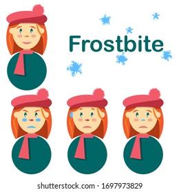 Cute young white girl happy healthy and sad with frostbite symptoms. Blue blanching ear, lips, nose, cheeks. Red hair, beret, snowflakes. Isolated flat vector.
