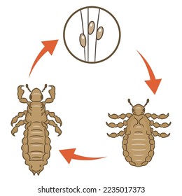 Ciclo de piojos de cabeza, ilustración vectorial