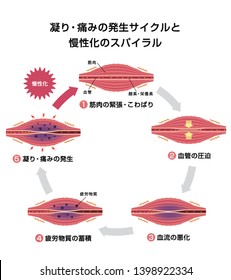 Cycle of stiffness and pain , and spiral of chronicification illustration / Japanese.translation: Muscle becomes tense,Blood vessel compressed,Blood flow worse,Fatigue factors accumulate etc.