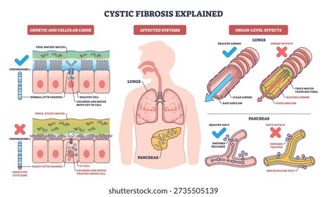 Cystic fibrosis explained, visual summary of CFTR mutation causing thick mucus in lungs and pancreas, contrasting clear and blocked airways to show disease effects. Outline diagram