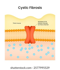 Cystic Fibrosis Symptoms and Causes