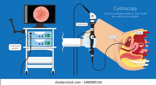 Cystoscopy Images Stock Photos Vectors Shutterstock