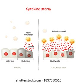 Cytokine Storm Or Hypercytokinemia. COVID-19 Complications. Physiological Reaction In Which The Innate Immune System Causes An Uncontrolled And Excessive Release Of Pro-inflammatory Signaling Molecule