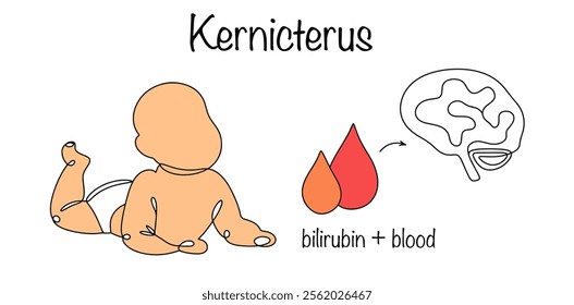 Damage to the newborn's brain due to the direct cytotoxic effect of high concentrations of bilirubin in the blood. A diagram of the disease and a baby with skin color characteristic of kernicterus.