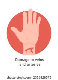 Damage To Veins And Arteries Vector Illustration