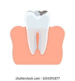Damaged caries tooth. Flat vector cartoon illustration. Objects isolated on white background.