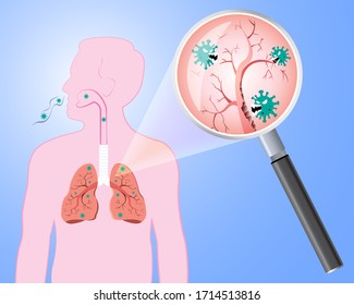 Damaged from Coronavirus cells with magnifying glass inspecting the affected on lung. COVID-19 with scary and evil face eating lung. 2019-nCoV concept.