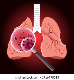 Damaged from Coronavirus cells with magnifying glass inspecting the affected on lung. 2019-nCoV concept.