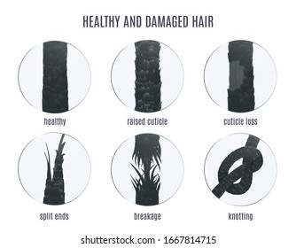 Damaged hair surface under microscope. Hair follicle structure condition closeup vector set. Problem of split ends, breakage, knotting, raised cuticle and loss of cuticle. Trichology medical concept. 