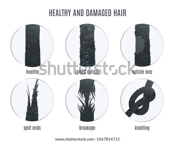 Damaged hair surface under microscope. Hair follicle\
structure condition closeup vector set. Problem of split ends,\
breakage, knotting, raised cuticle and loss of cuticle. Trichology\
medical concept. 