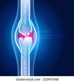Damaged joint illustration, abstract x ray design.