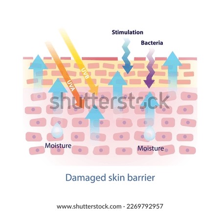 Damaged skin barrier vector on white background. The weak skin barrier make tight arrangement between cells is lost, irritants to get in easier and dehydrated skin.  Skin care and beauty concept.