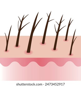 Damaged and split ends hair on scalp layer vector illustration isolated on white background. Dryness, baby split, y split, incomplete, knot, taper, tree and feather. Hair care and problem concept.