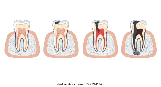 Damaged tooth Illustration, Damaged Teeth, Dentist Vector Illustration, Oral Care