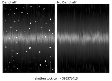 dandruff and good hair , before and after , vector