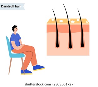 Dandruff hair problems and treatment. Cartoon man character with white flake in head. Scuff on the human scalp. Skin layers diagram, epidermis and dermis medical poster flat vector illustration