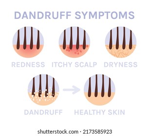 2,732 Anti Dandruff Images, Stock Photos & Vectors | Shutterstock