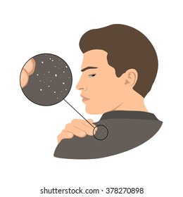 Dandruff issue on man's shoulder. Close up view. Vector illustration.