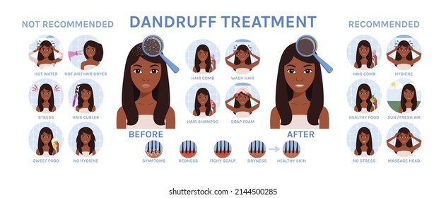 Dandruff on Female Head. Black Woman Treats Scalp from Dandruff. Set. Healthy Hair  and Happy Lady. Recommendations. Cartoon style. White background. Vector illustration for Medical and Beauty design.