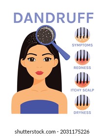 Dandruff on Hair. Scalp Disease and Beautiful Woman. Magnifying Blass and Close up view of Dandruff. Icons of Symptoms: Dryness, Redness, Itchiness. Image in Cartoon style. White background. Vector