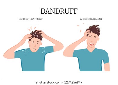 Dandruff on the scalp bothers the person. Fungal diseases of the skin, dermatology. Medical banner concept of the disease before and after treatment. Vector illustration