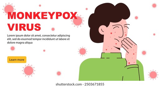 Danger of Mpox virus concept banner. Infected boy from monkey flat illustration. Monkeypox on human skin