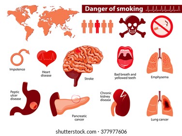 danger smoking. Signs, symptoms, stage and risk factors. Medical infographic. Set elements and symbols for your design.