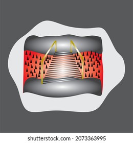 
dangerous hell bridge drawing illustration