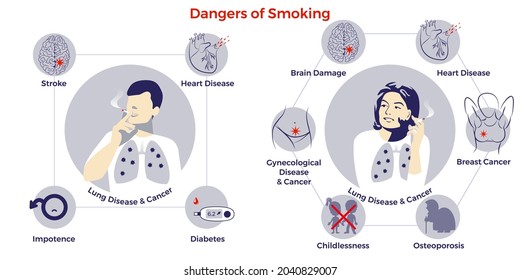 Dangers of smoking for men and women. Illness risk. Stop smoking. World no tobacco day. Air pollution. Infographic. Vector illustration. Healthcare poster, placard or banner template.