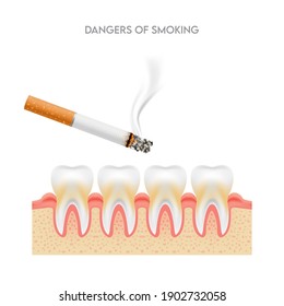 Gefahren des Rauchens, Zähne mit Zigarette. Raucheffekt auf die menschlichen Zähne. Konzept der Zahnpflege. Hör auf zu rauchen, Weltnichtrauchertag. Illustration auf weißem Hintergrund.