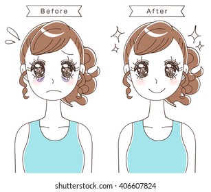 dark circles under eye