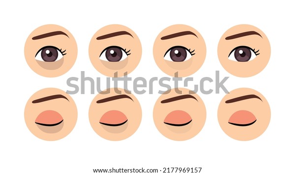 Dark Circles Under the Eye. Female Open and Closed\
Eye. Treatment of Periorbital Circles. Before After. Healthy Skin.\
Color Cartoon style. White background. Vector image for Medical and\
Beauty design