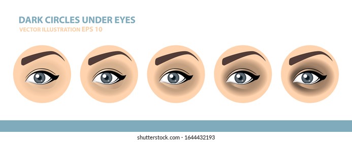 Dark Circles Under Eyes. Female Eye. Vector Illustration