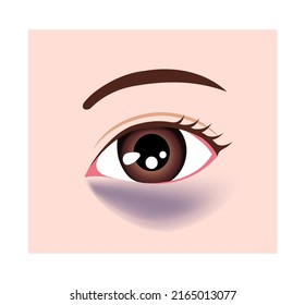 Dark circles under eyes vector illustration ( blue circles )